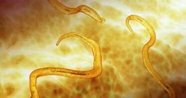 pinworm parasites in the human body