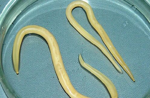 roundworms from the child's body