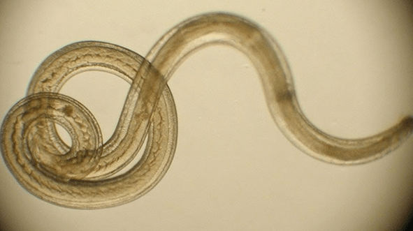 a worm parasite from the human body