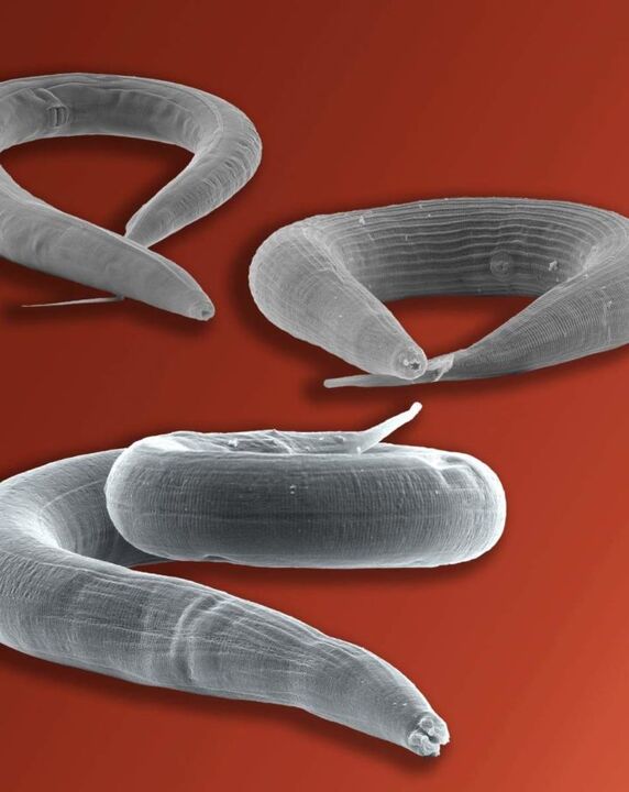 a pinworm parasite that lives in the gut