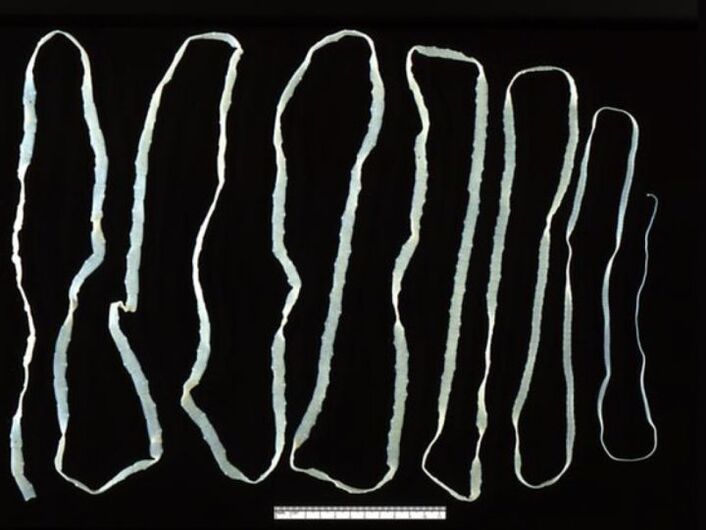 bovine tapeworm enters a person through beef
