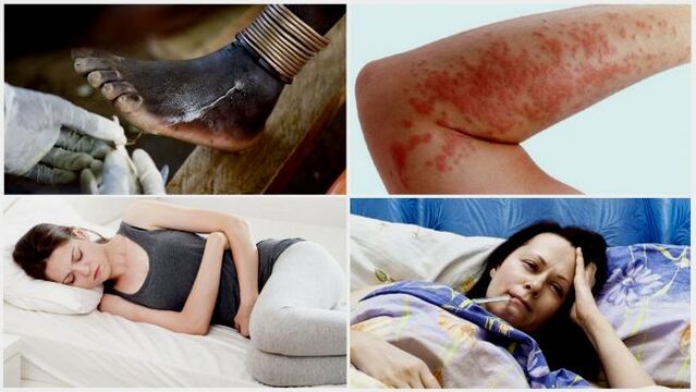 Common symptoms of subcutaneous parasite infestation