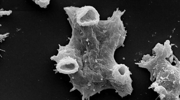 Negleria fowlera is a protozoan parasite dangerous to human life. 